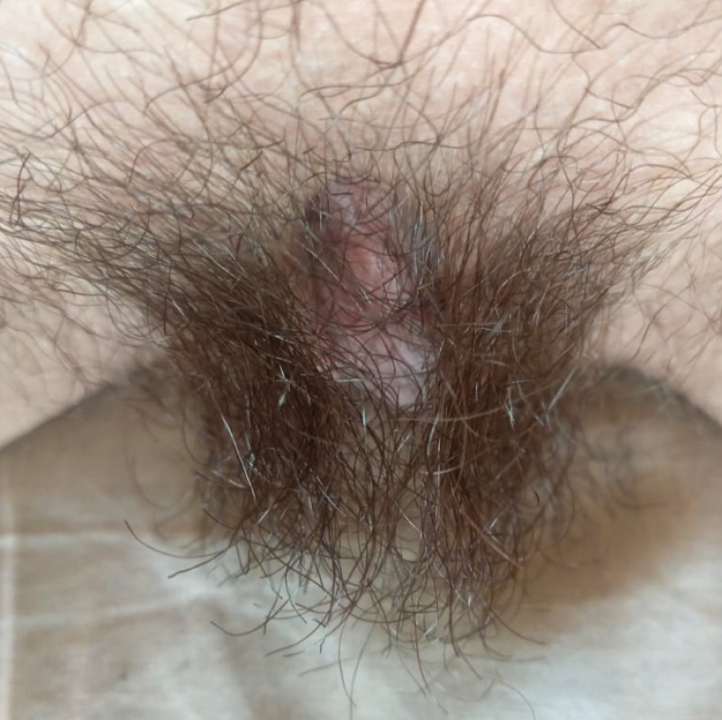 Trimmed Long public hair